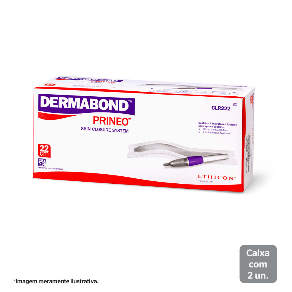 CLR222 | DERMABOND PRINEO 22 CM
